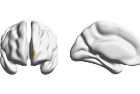 Image of brain from front and side